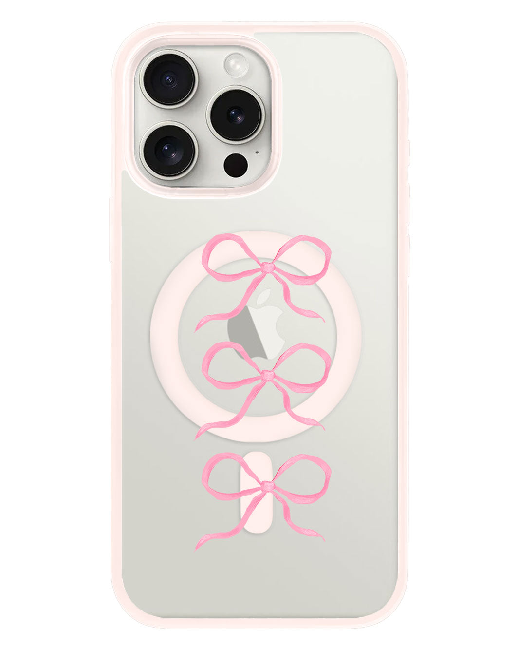 iPhone Rearguard Hybrid - โคเค็ต ทริปเปิ้ล โบว์