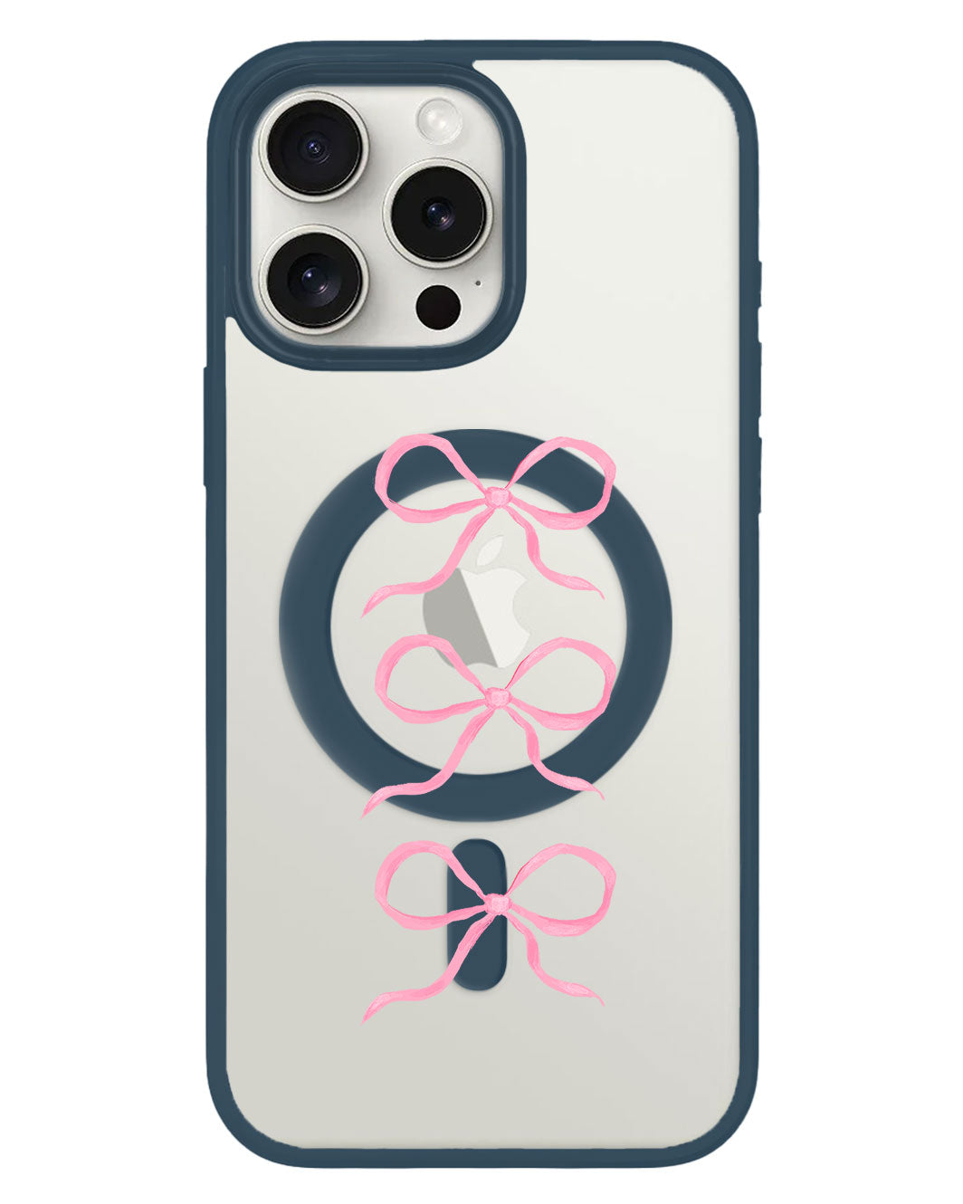 iPhone Rearguard Hybrid - โคเค็ต ทริปเปิ้ล โบว์