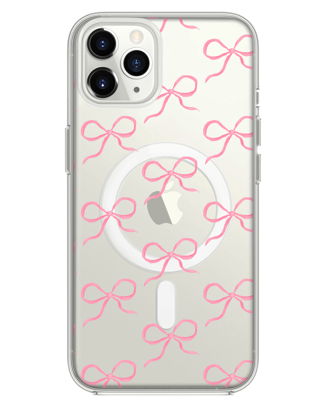 iPhone Rearguard Hybrid - สี Coquette Pink Bow