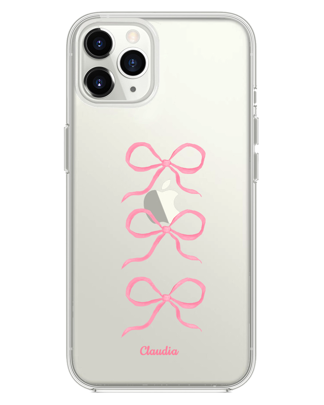 iPhone Rearguard Hybrid - โคเค็ต ทริปเปิ้ล โบว์