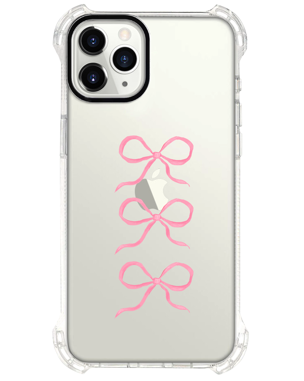 iPhone Rearguard Ultimate - โคเค็ต ทริปเปิ้ล โบว์