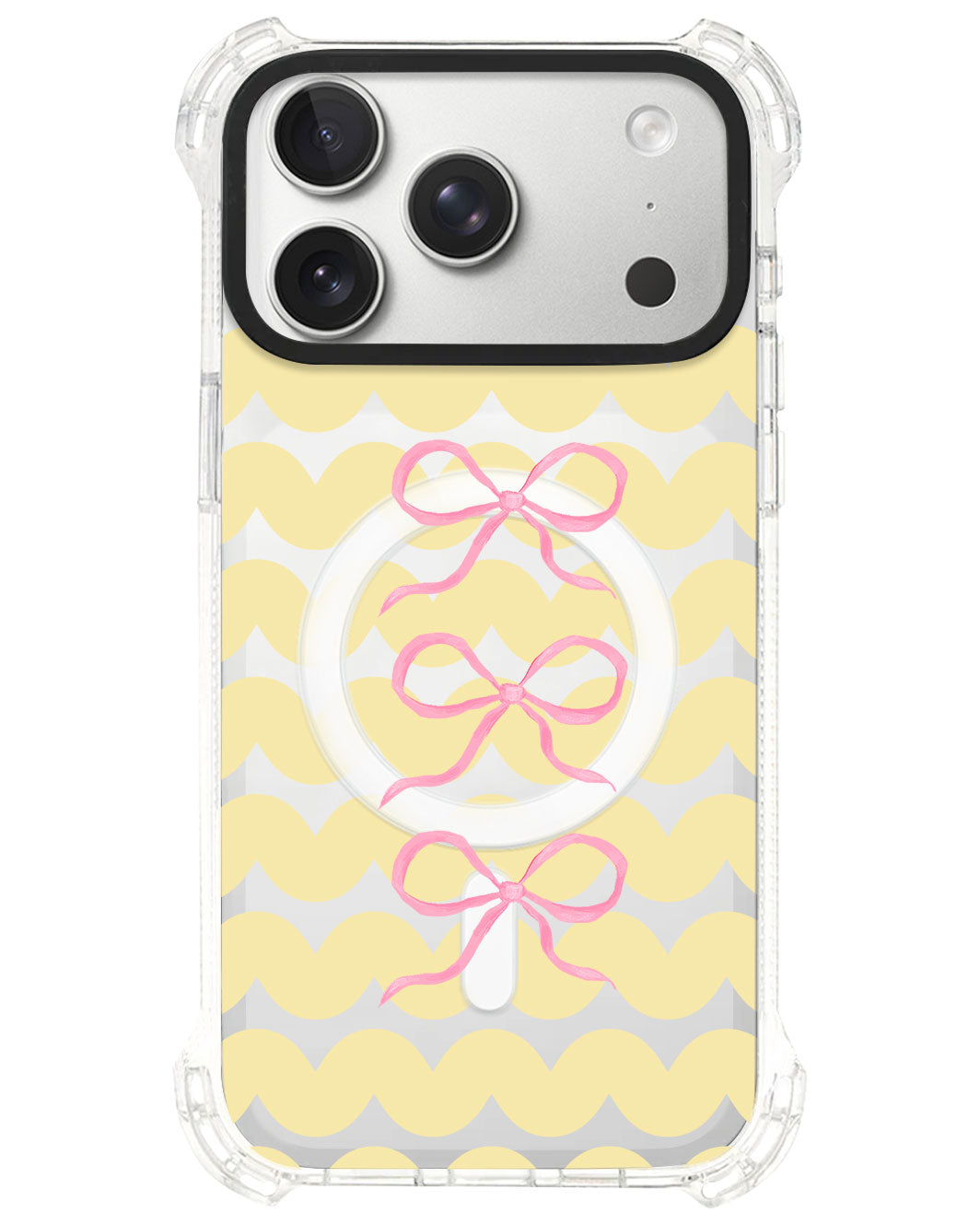 iPhone Ultimate Model-S⁴ - Coquette Triple Bow