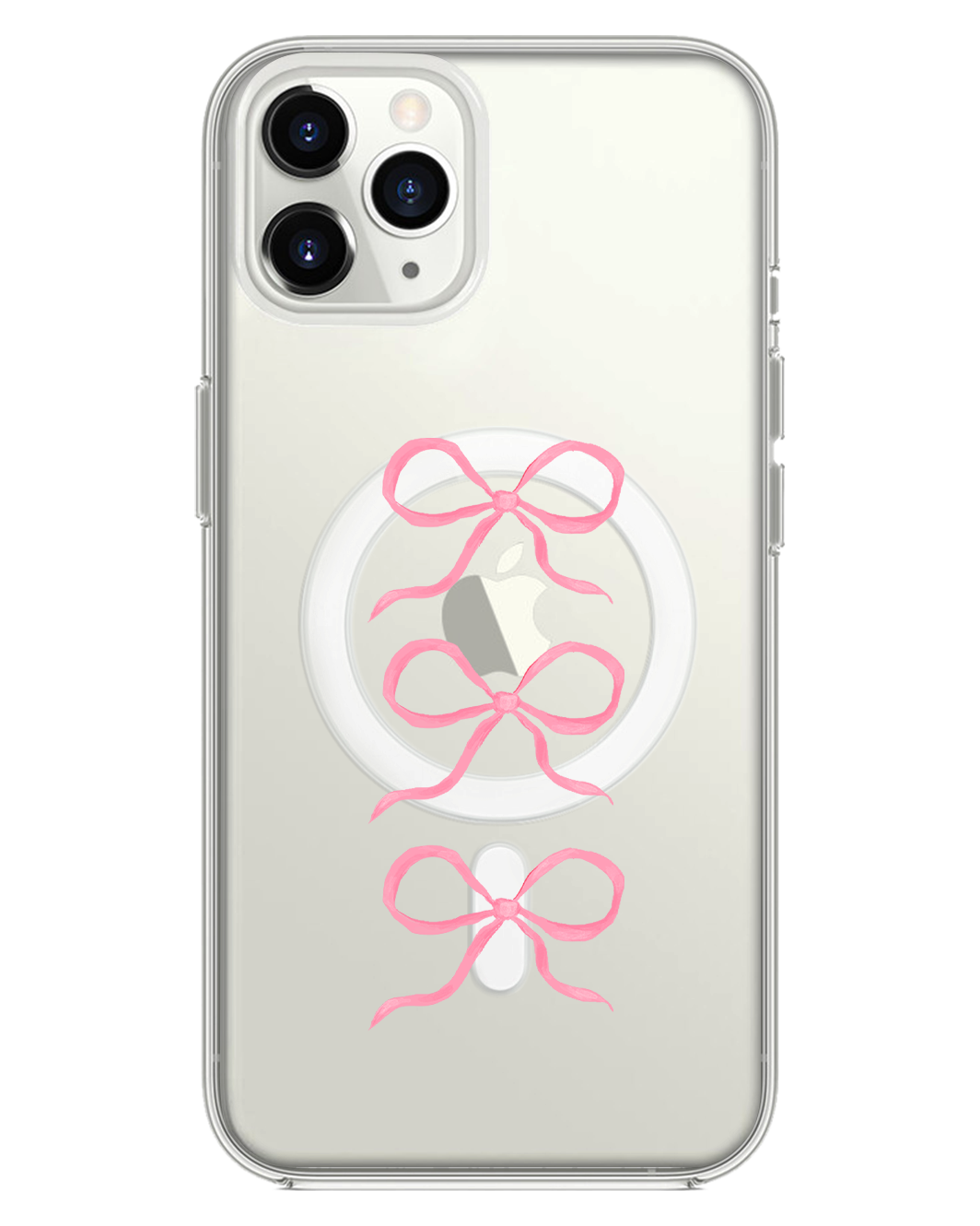 iPhone Rearguard Hybrid - โคเค็ต ทริปเปิ้ล โบว์